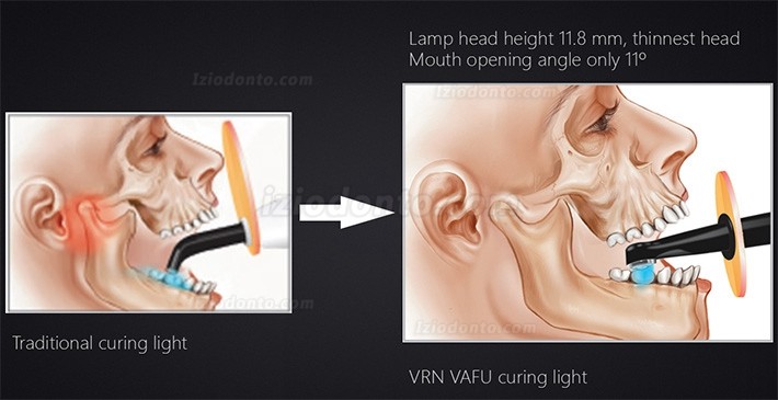 VRN VAFU Fotopolimerizador Sem Fio com detecção de cárie & Radiômetro LED